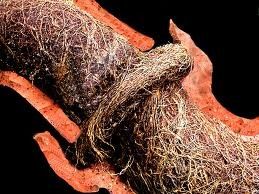 有树根侵入的下水道